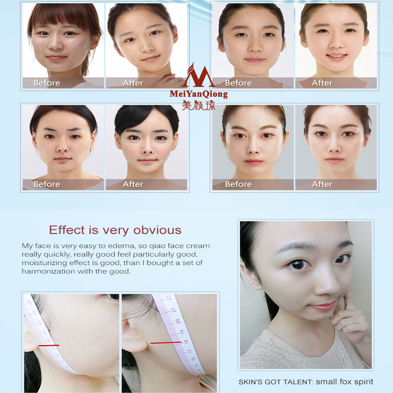Lifting twarzy kształtowanie k – Luxury Skincare China recenzja i cena